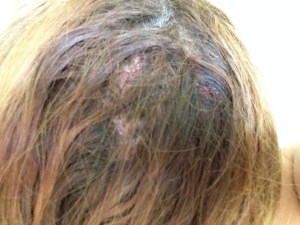 I hate this picture, it is not only gross but it is a reminder of something that happened just a few weeks ago. A quick draw from far away was dropped and hit my head. I am ok, but I realize I am reminded I am not invincible.